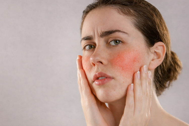 Pores & Sébum