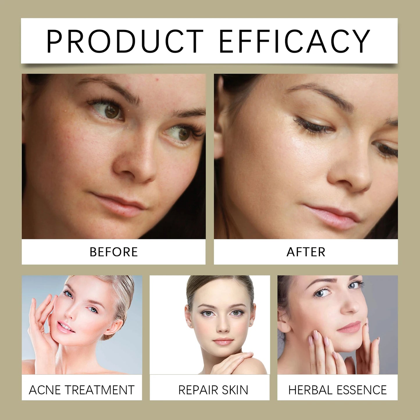 Tonique à l'Acide Glycolique 7% – Exfoliant, Hydratant & Éclat