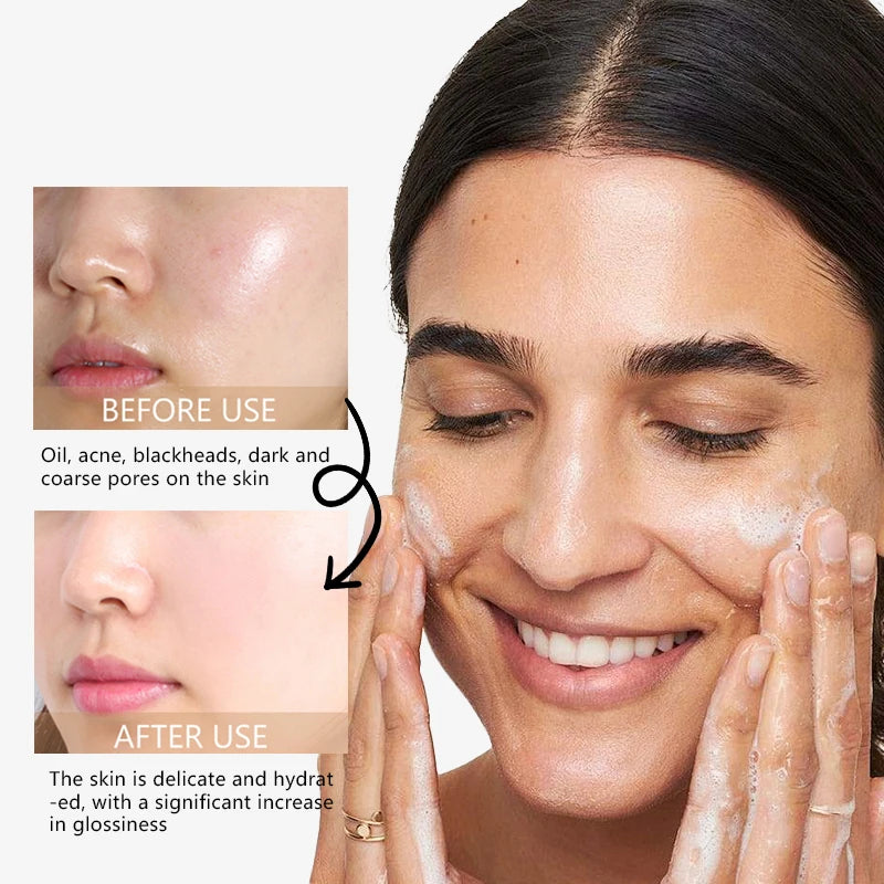 Nettoyant Visage Low pH Doux – Nettoyage Profond & Respectueux