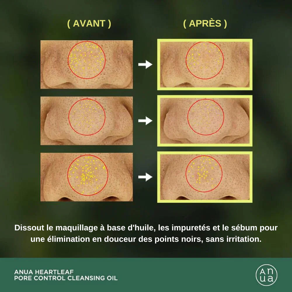Anua – Huile Nettoyante Heartleaf Pore Control pour Peaux Sensibles