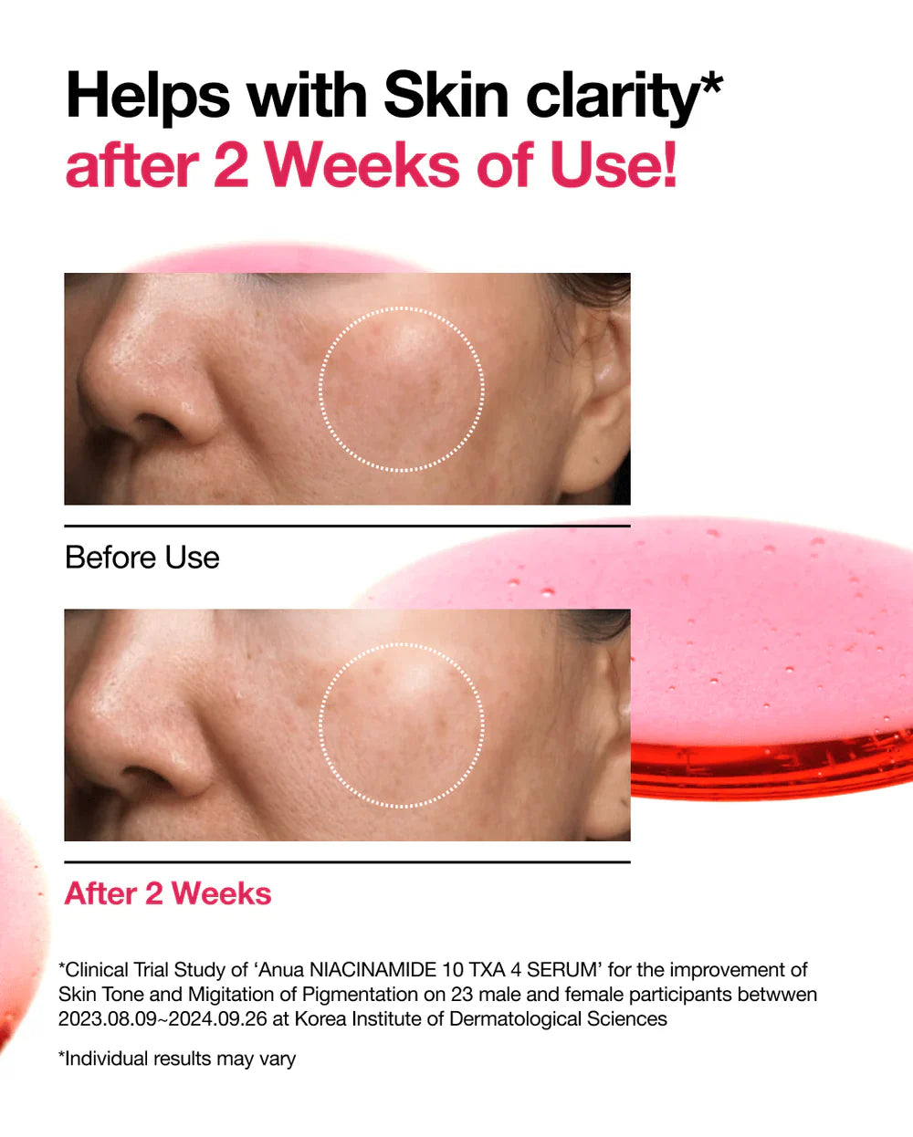 Sérum Correcteur Teint Niacinamide 10% + TXA 4%